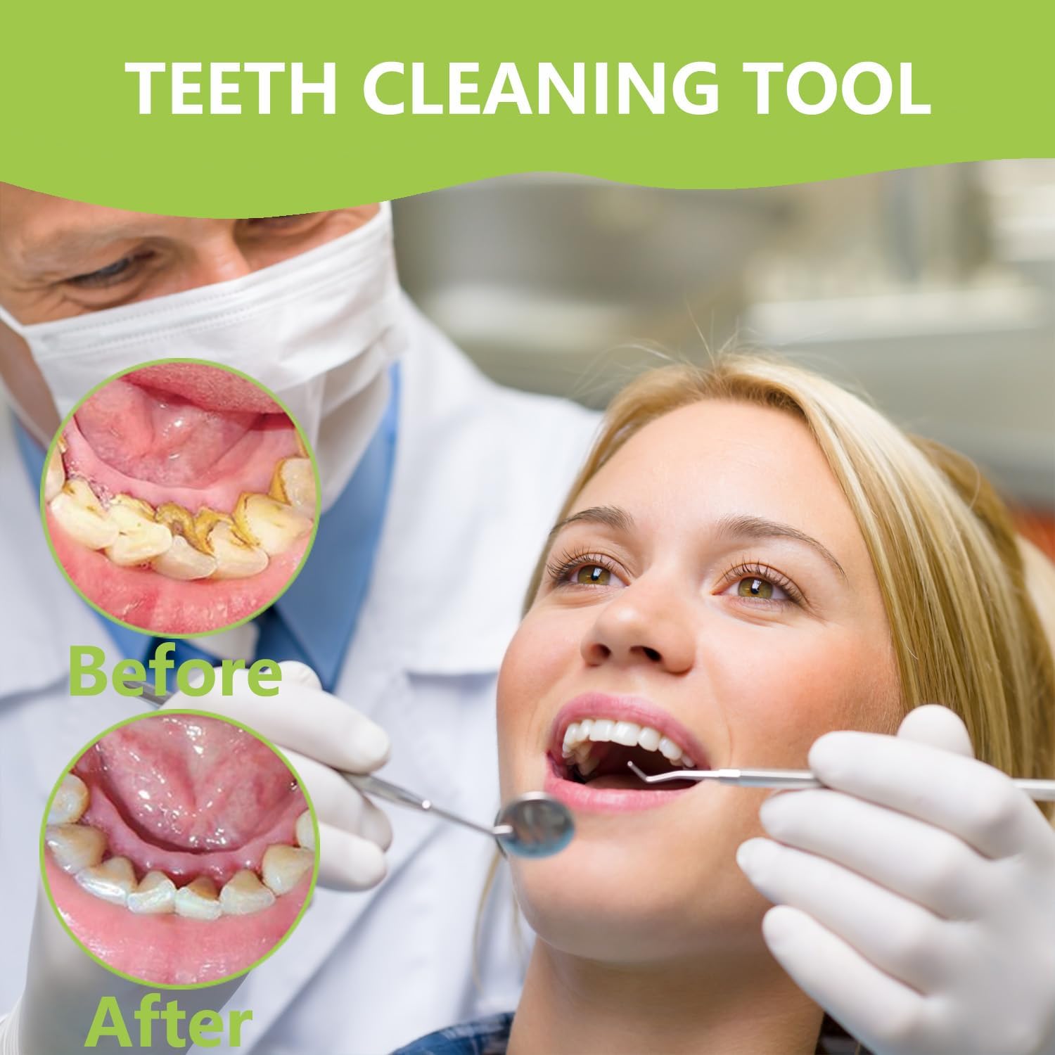 ชุดทำความสะอาดฟันระดับมืออาชีพ - Teeth Whitening Mouthwash บทวิจารณ์และราคา