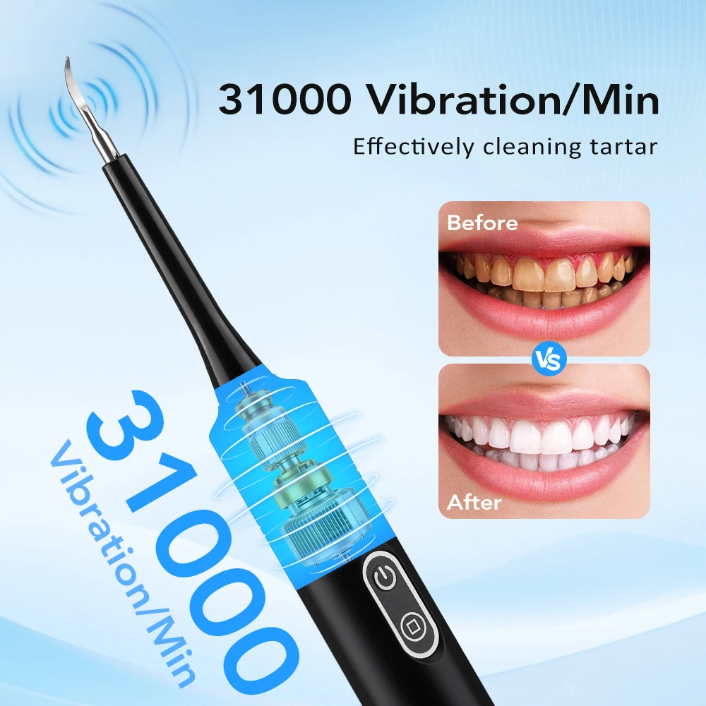 เครื่องขจัดคราบหินปูนไฟฟ้าแบบส - Teeth Whitening Mouthwash บทวิจารณ์และราคา