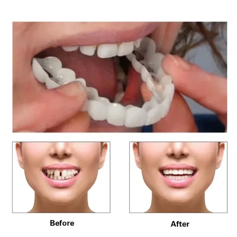 ชุดฟันปลอมแบบสวม ปรับได้ ฟันปล - Teeth Whitening Kit บทวิจารณ์และราคา
